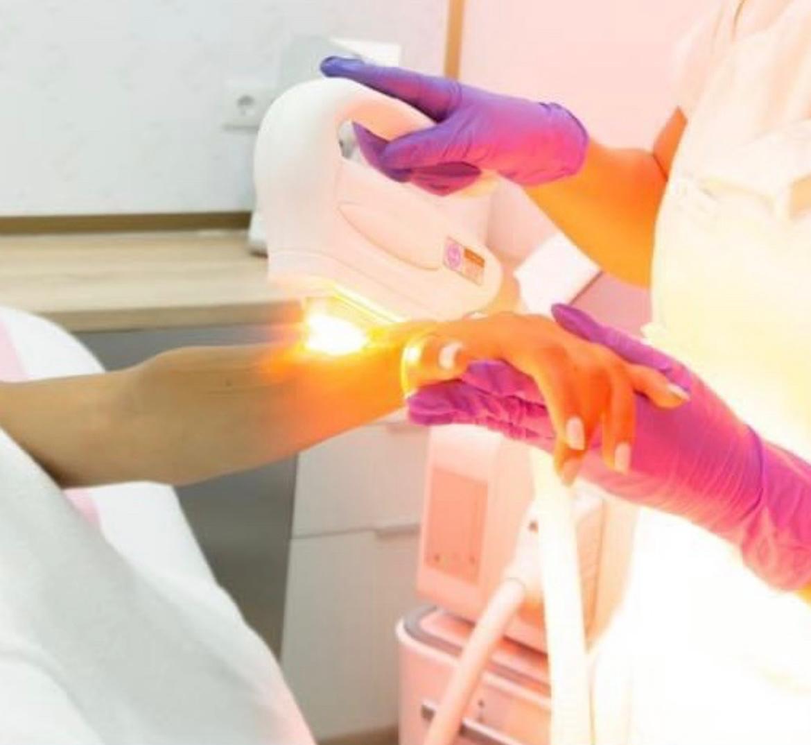 Depilación láser SHR-V